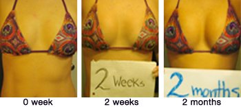 Boost Curves Breasts Enhancement Pills Before and After