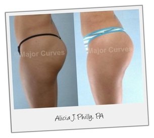 Major Curves Butt Enhancement Pills Before And After